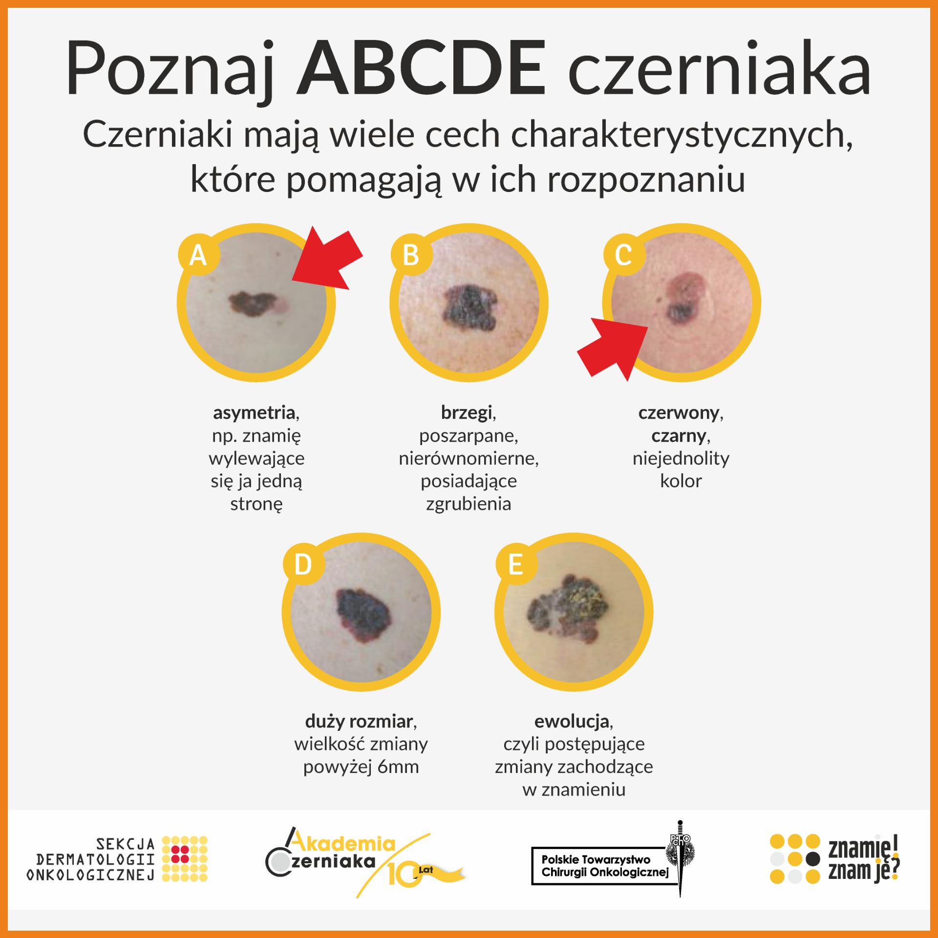 Plakat promujący program profilaktyczny poświęcony czerniakowi. 